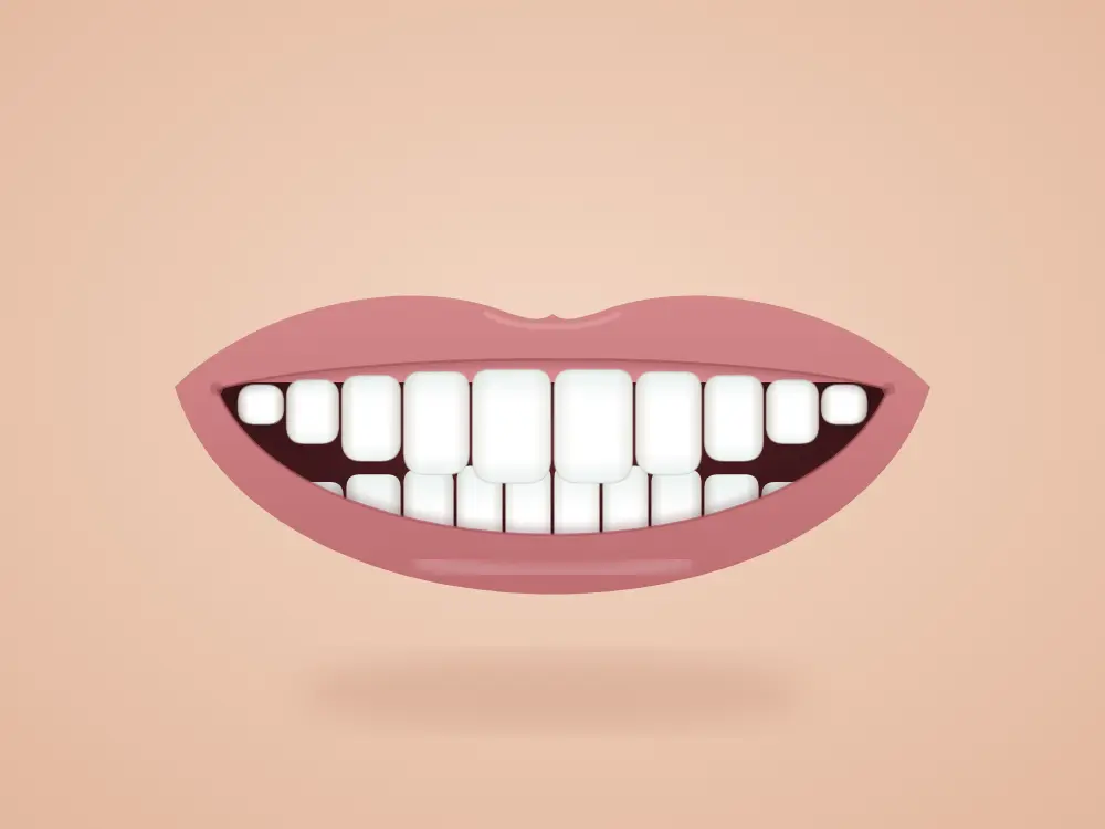 Klinik ağartma — Sonra